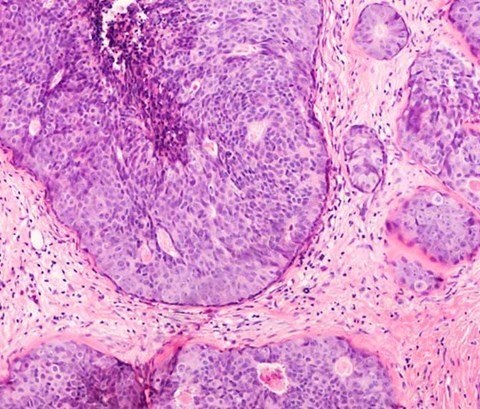 10 Key Features of Studying a Master's in Cancer Cell Biology in the UK